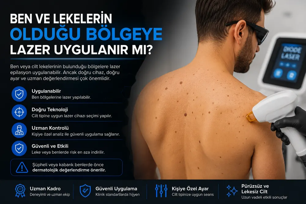 Erkek lazer epilasyon seansı öncesi ciltteki ben ve lekelerin işaretlenerek korunması