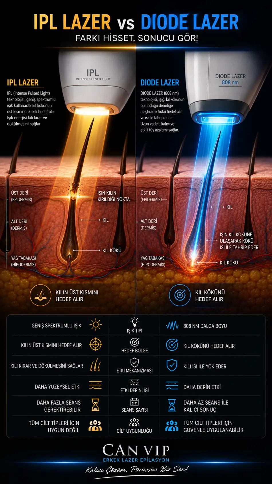 IPL lazer ile diode 808 nm buz lazerin erkek lazer epilasyonundaki karşılaştırma tablosu