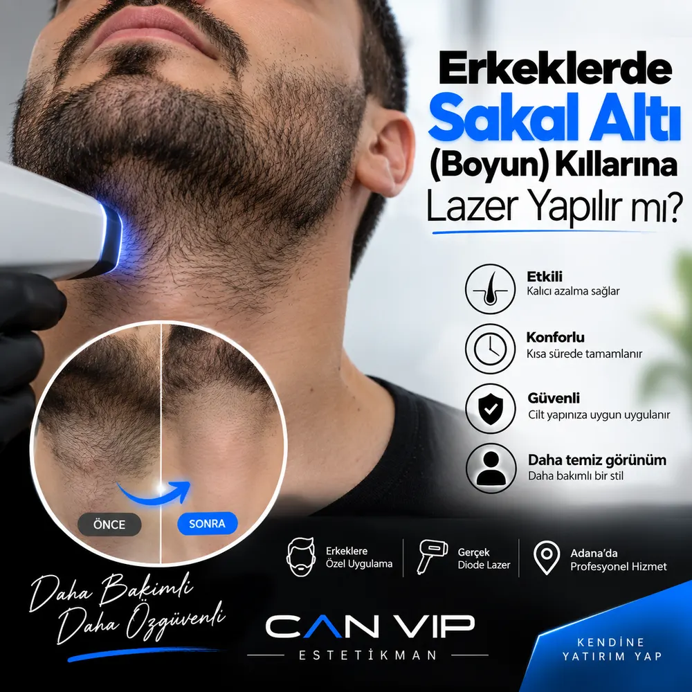 Adana erkek lazer epilasyon uygulamasında sakal altı ve boyun bölgesinin sınırlarının belirlenmesi